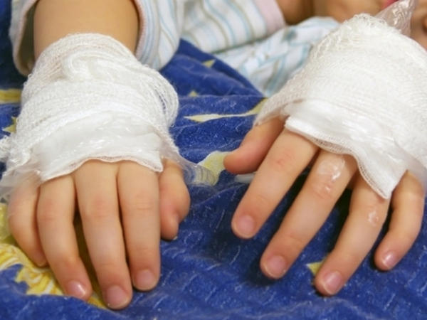 В Кременчугскую больницу в тяжелом состоянии попал годовалый ребенок