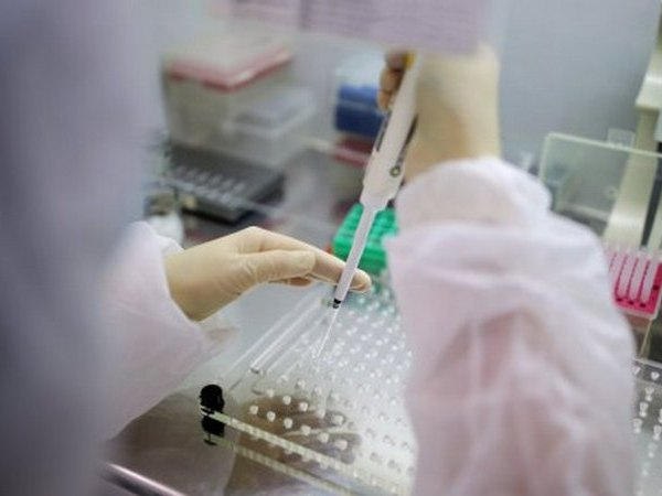 В Кременчуге готовы проводит тесты на наличие антител к Covid-19
