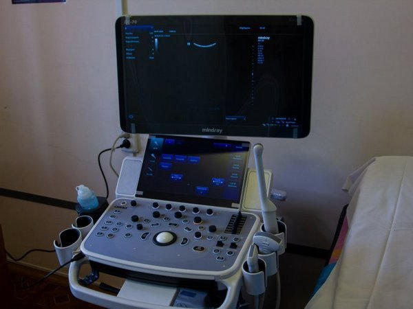 В Кременчугском госпитале для ветеранов появился новый аппарат УЗИ
