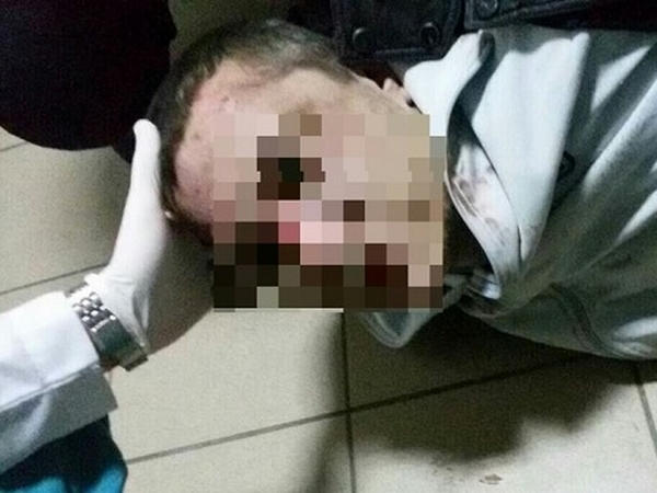 Кременчугской полиции пришлось усмирять парня, который бился головой об землю