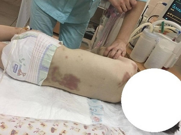 Отчим, забивший до смерти своего пасынка, проведет еще 2 месяца в кременчугском СИЗО