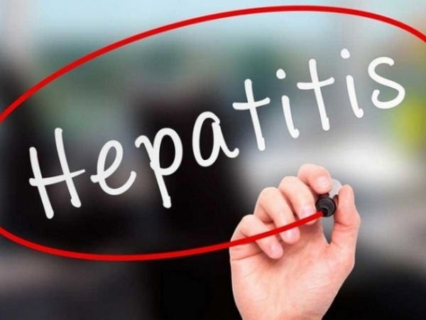 В Кременчуге зафиксировали факт заболевания острым вирусным гепатитом
