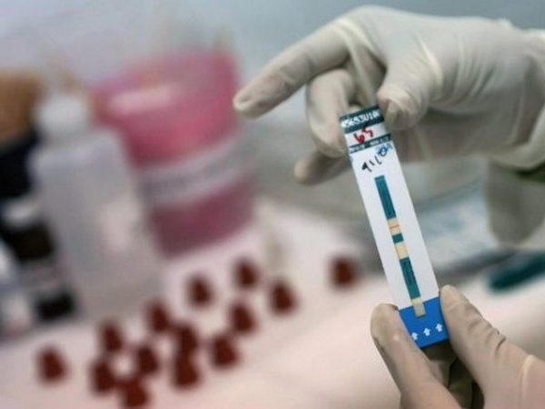 Экспресс-тестирование на ВИЧ кременчужане могут пройти у своего семейного врача