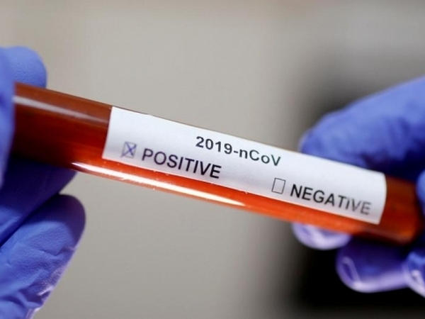За день в Кременчуге зарегистрировано 41 новый случай заболеваемости на коронавирус