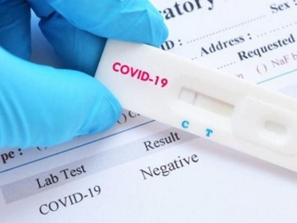 Кременчуг получил новые экспресс-тесты на определение антител к коронавирусу
