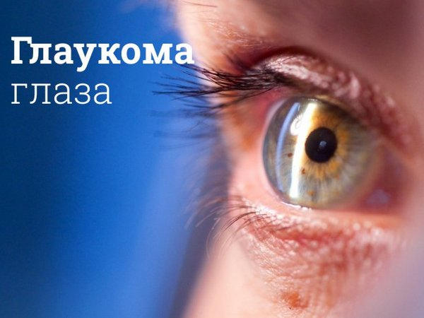 Что такое глаукома глаза