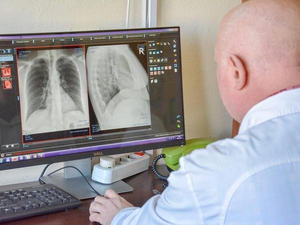 В этом году в Первой городской больнице Кременчуга заработает новый цифровой рентгенаппарат