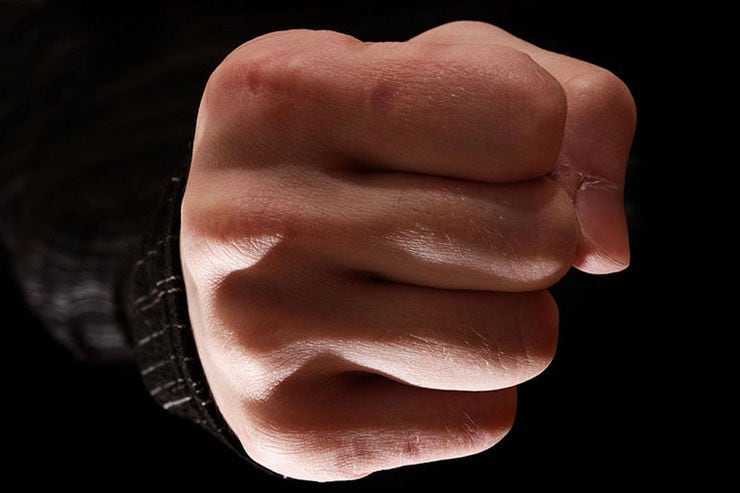 В Кременчуге 58-летнего мужчину жестоко избили в общежитии