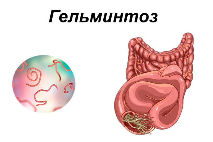 Лечение Альбендазолом, таблетки от глистов, гельминтов